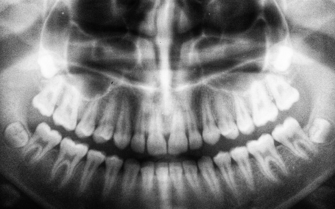 The Radical World of Dental X-Rays