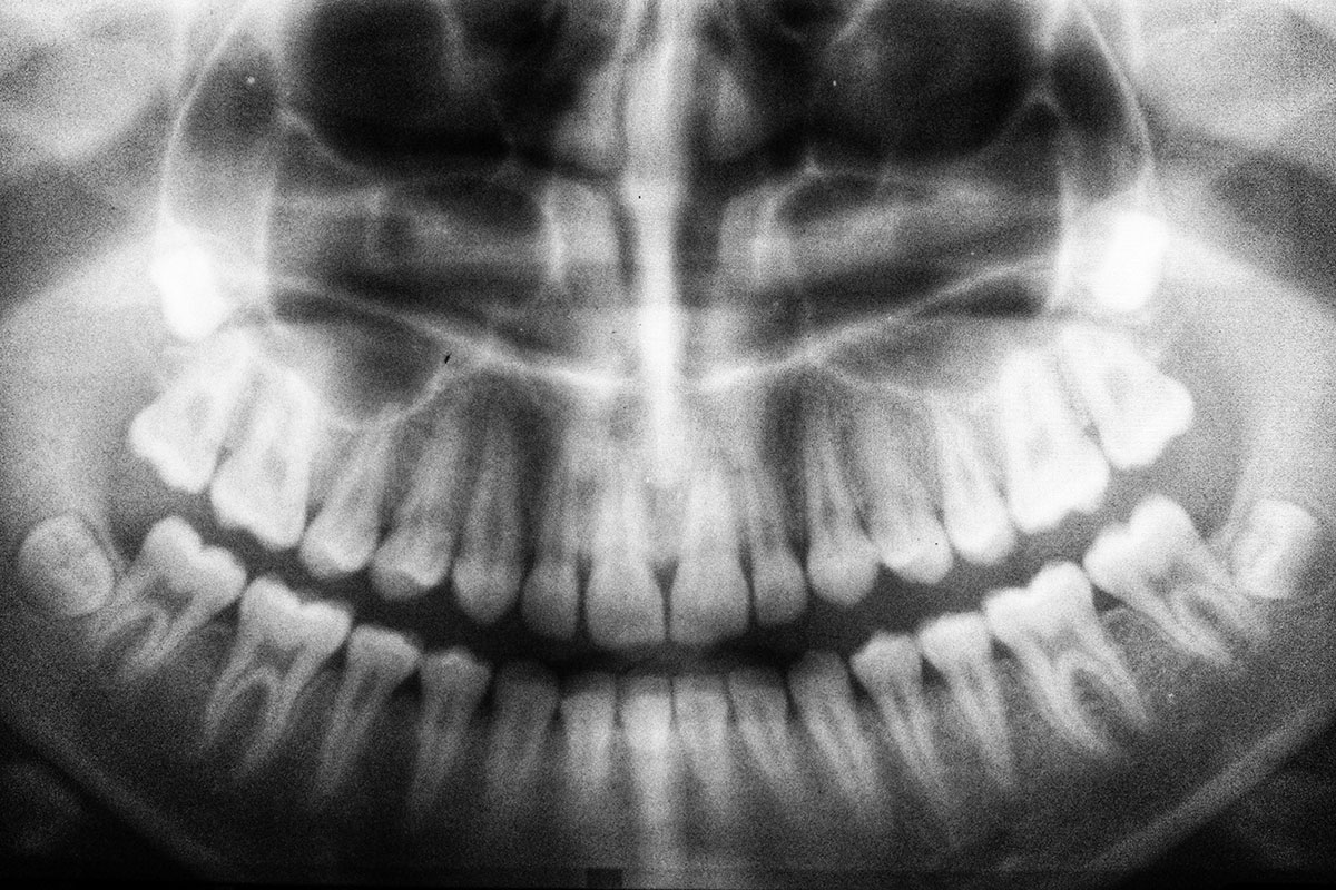 Panoramic image of dental x-rays