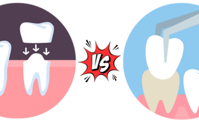 Dental Crowns vs. Veneers: A Comprehensive Guide to Enhancing Your Smile