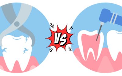 Root Canal vs. Tooth Extraction: Your Comprehensive Guide to Dental Decision-Making