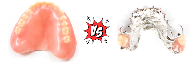 Full Dentures vs. Partial Dentures: Your Complete Guide to Choosing the Right Fit